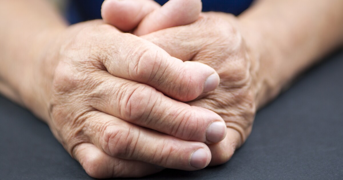 Call to revise hand arthritis treatments due to efficacy concerns Call to revise hand arthritis treatments due to efficacy concerns