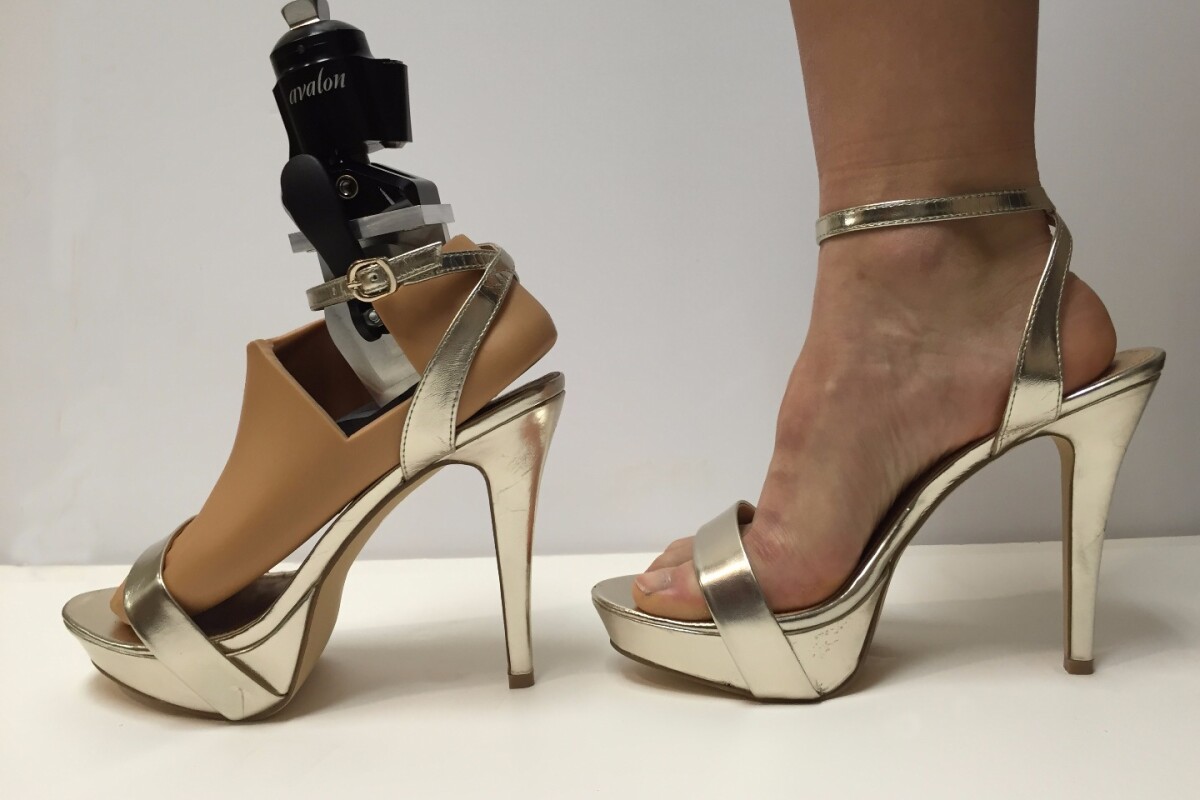 The prosthesis is reported to perform admirably, weighing in at less than 3 lb and supporting weights up to 250 lb