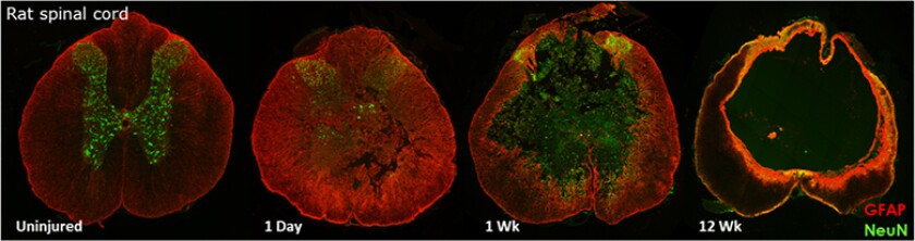 Composite image showing neural activity in rat spinal cord following gene therapy