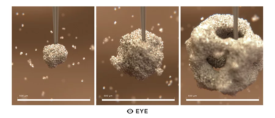 The EYEs are formed through 3D bioprinting, with a special needle distributing different kinds of cells that automatically gather together to make an eye