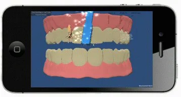 In the game "Monster Chase", monsters are hidden amongst a set of virtual teeth to draw brushing to all regions of the mouth