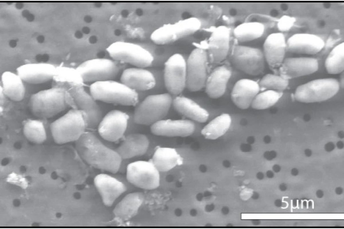 The GFAJ-1 bacteria, grown on arsenic