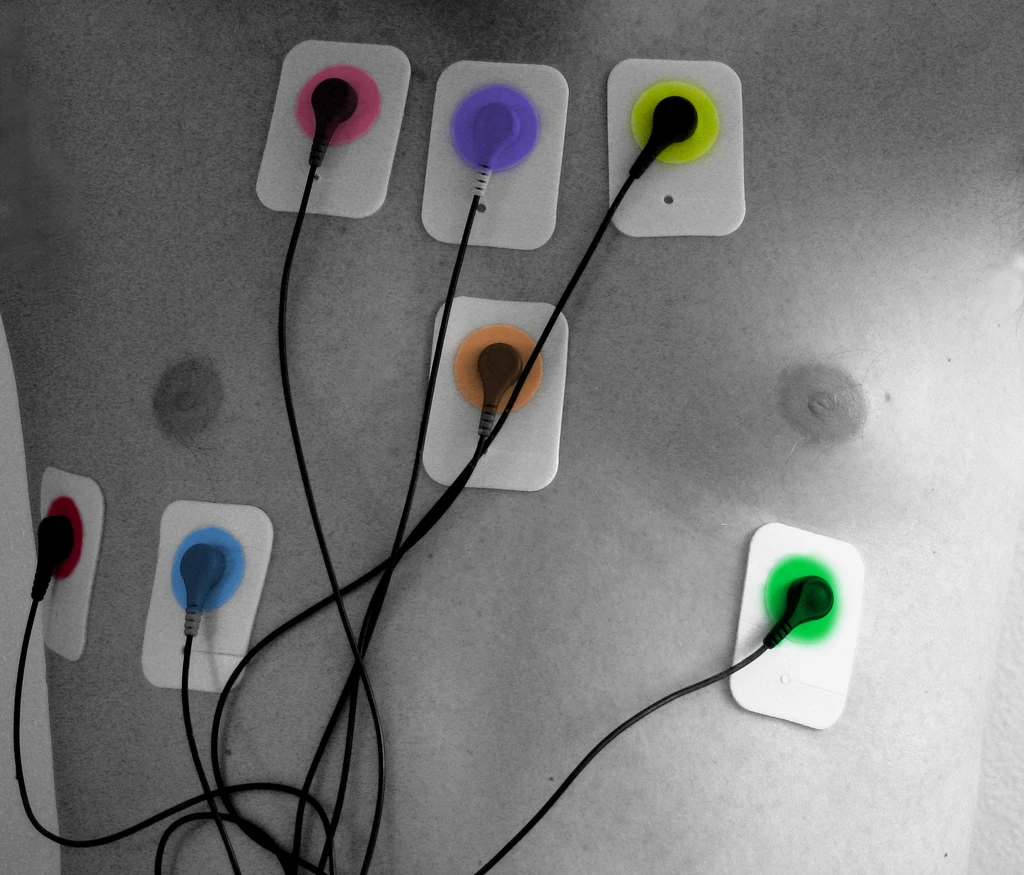 Electrodes could become a thing of the past, thanks to new research into the use of microwaves (Photo: Rennett Stowe, CC 2.0)