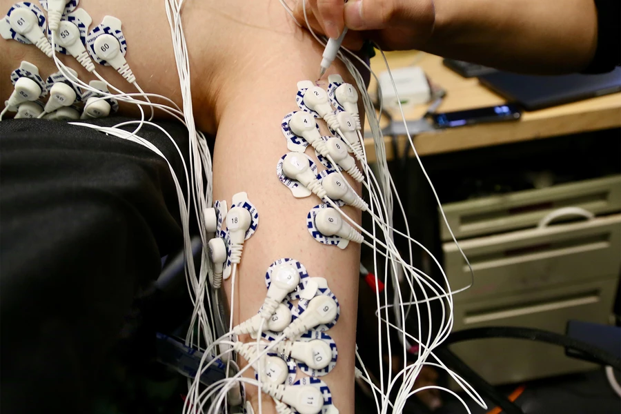 A test subject's leg is wired up with electrodes, to monitor the electrical activity of the muscles