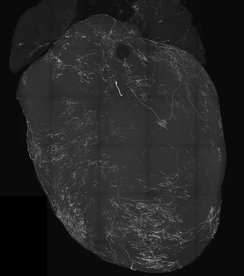 An image of a heart labeled by vagal sensory neurons, which trigger fainting
