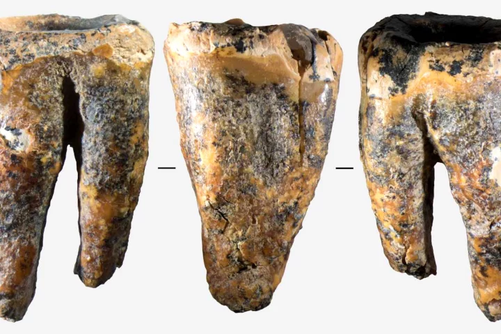 Chagyrskaya 64 molar tooth and its macro-features
