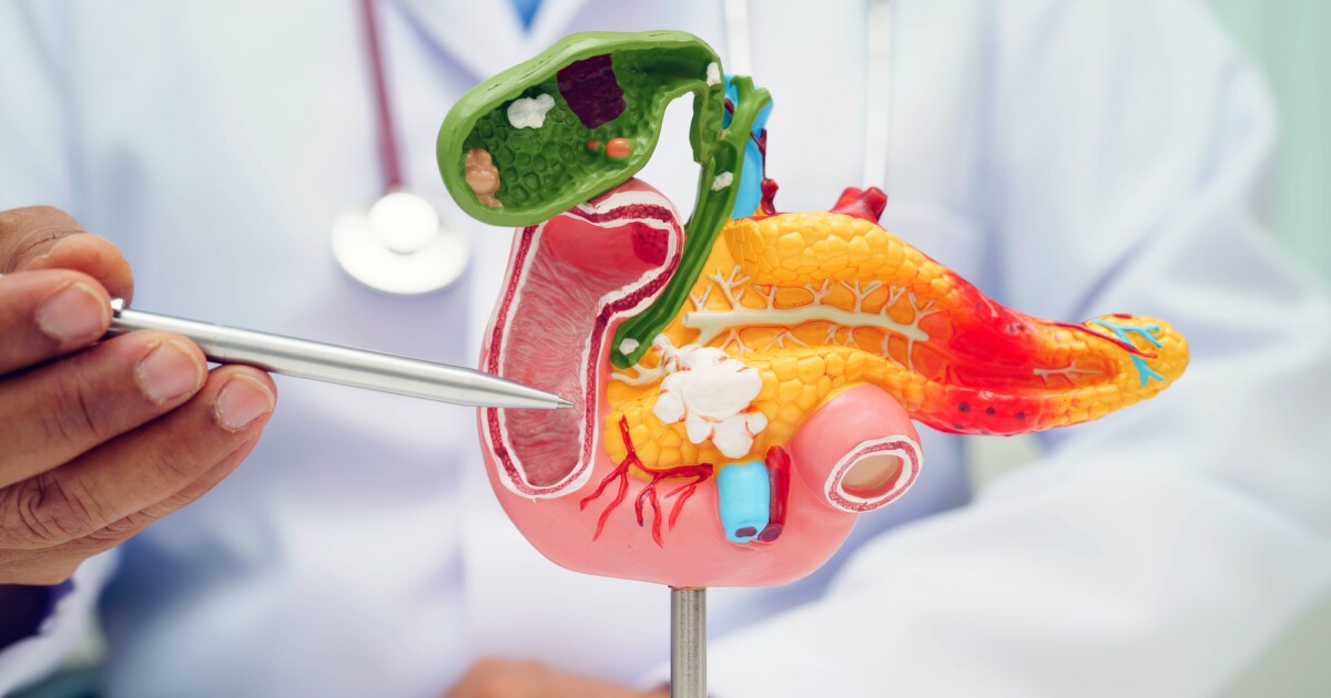New strategy targets pancreatic cancer’s hidden weakness New strategy targets pancreatic cancer’s hidden weakness