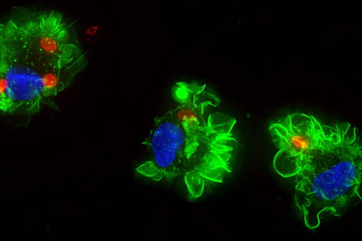Immune cells infected with the toxoplasma parasite (red)