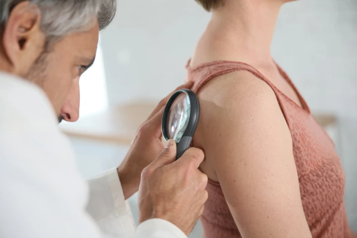 Researchers have identified a new target in the fight against melanoma