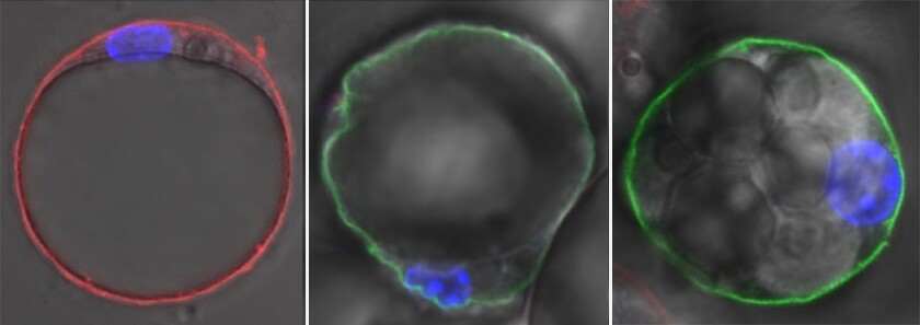 A white fat cell (left) fluoresces red and shows a single fat droplet; a brite brown cell (middle) shows a mix of both brown and white properties, while a cold-induced beige fat cell (right) contains many liquid droplets