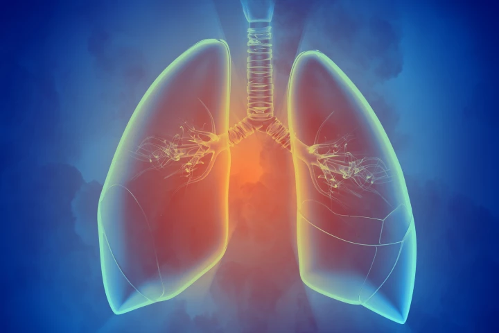 A new study has provided the first evidence of plastic particles traveling deep into the lungs of humans