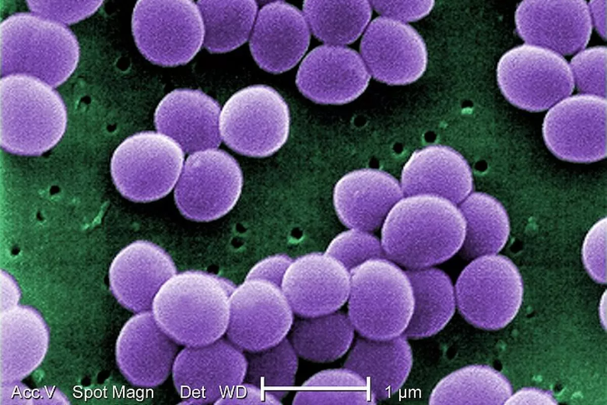 IBM's "ninja polymers" are capable of killing antibiotic-resistant bacteria such as Staphylococcus aureus (pictured)