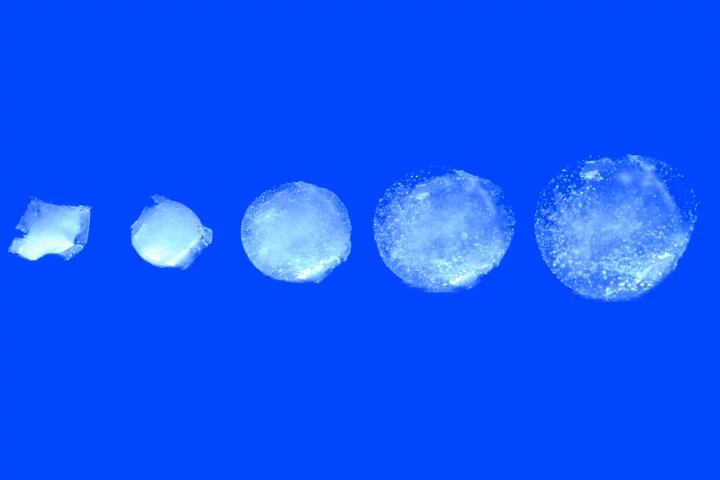 The pill has the potential to keep track of stomach health using a variety of sensors