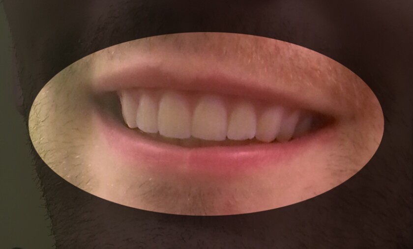 After Dudley's self-styled alignment