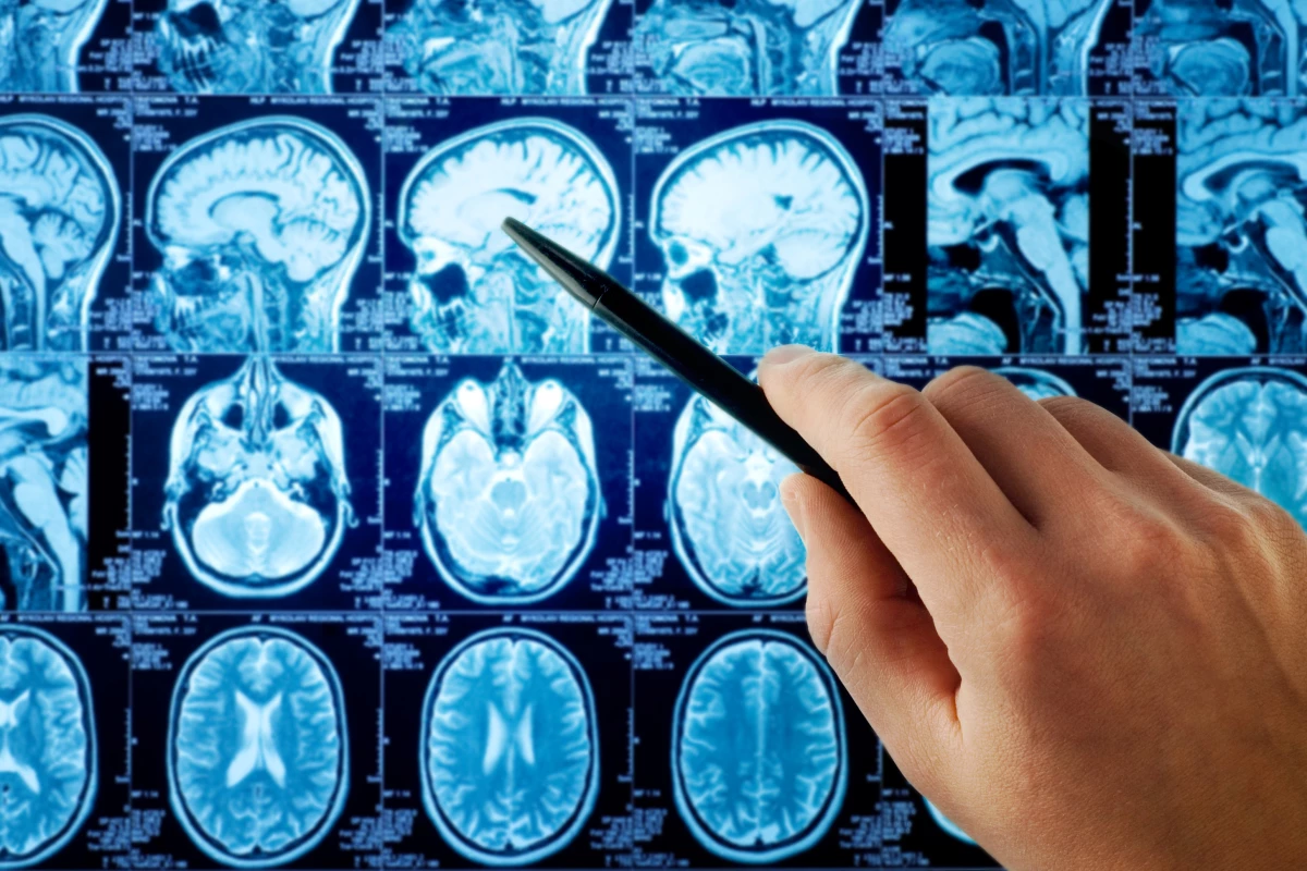 Age differences in brain activity may have been overestimated in the past because of noise in fMRI signals (Photo: Shutterstock)