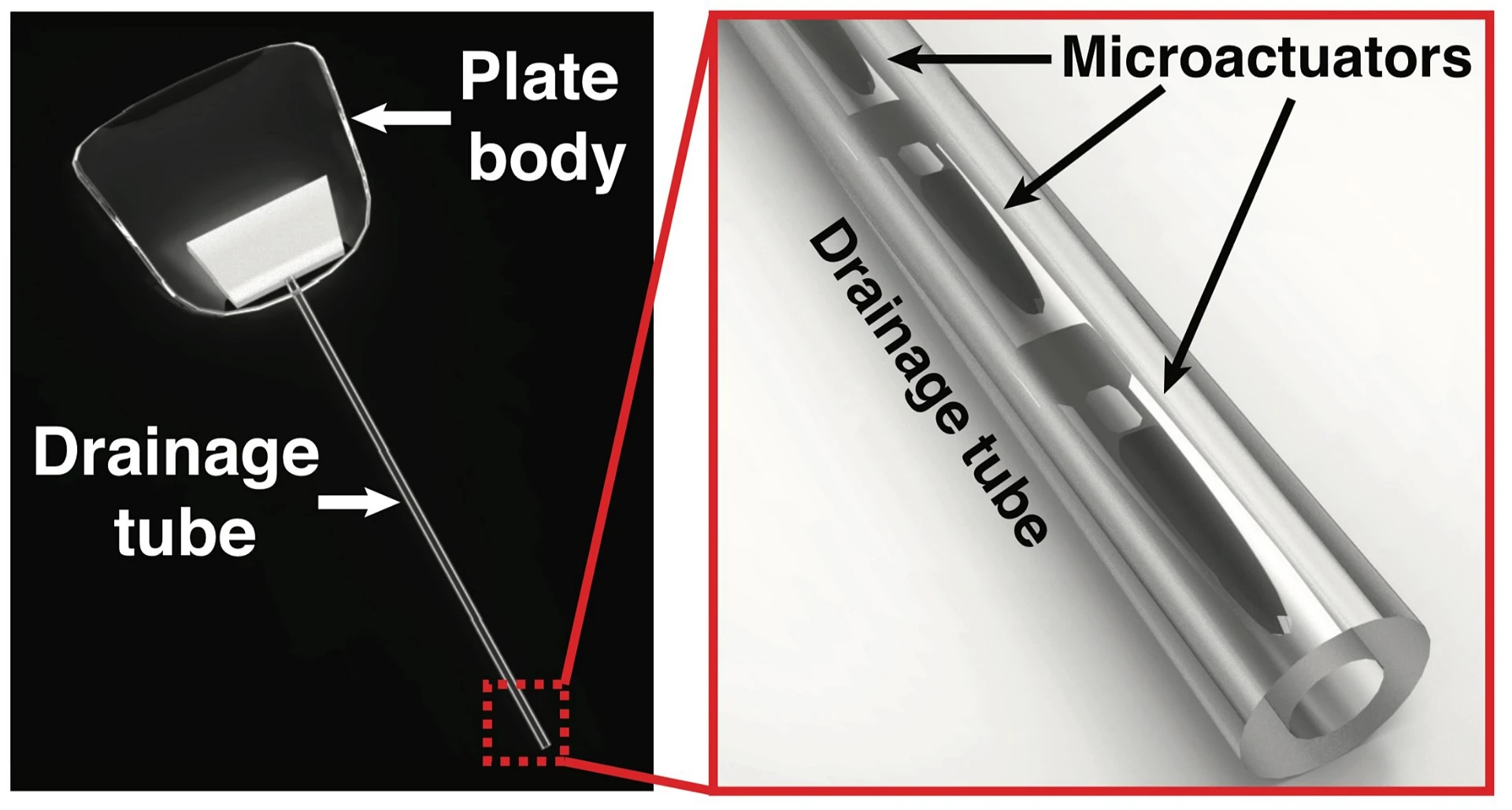 The implant is activated via externally-applied magnetic fields
