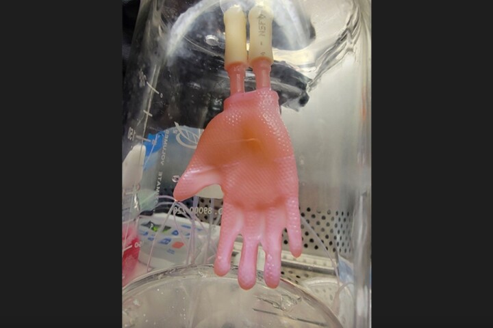 A one-piece "glove" of bioengineered skin, created using the new technology