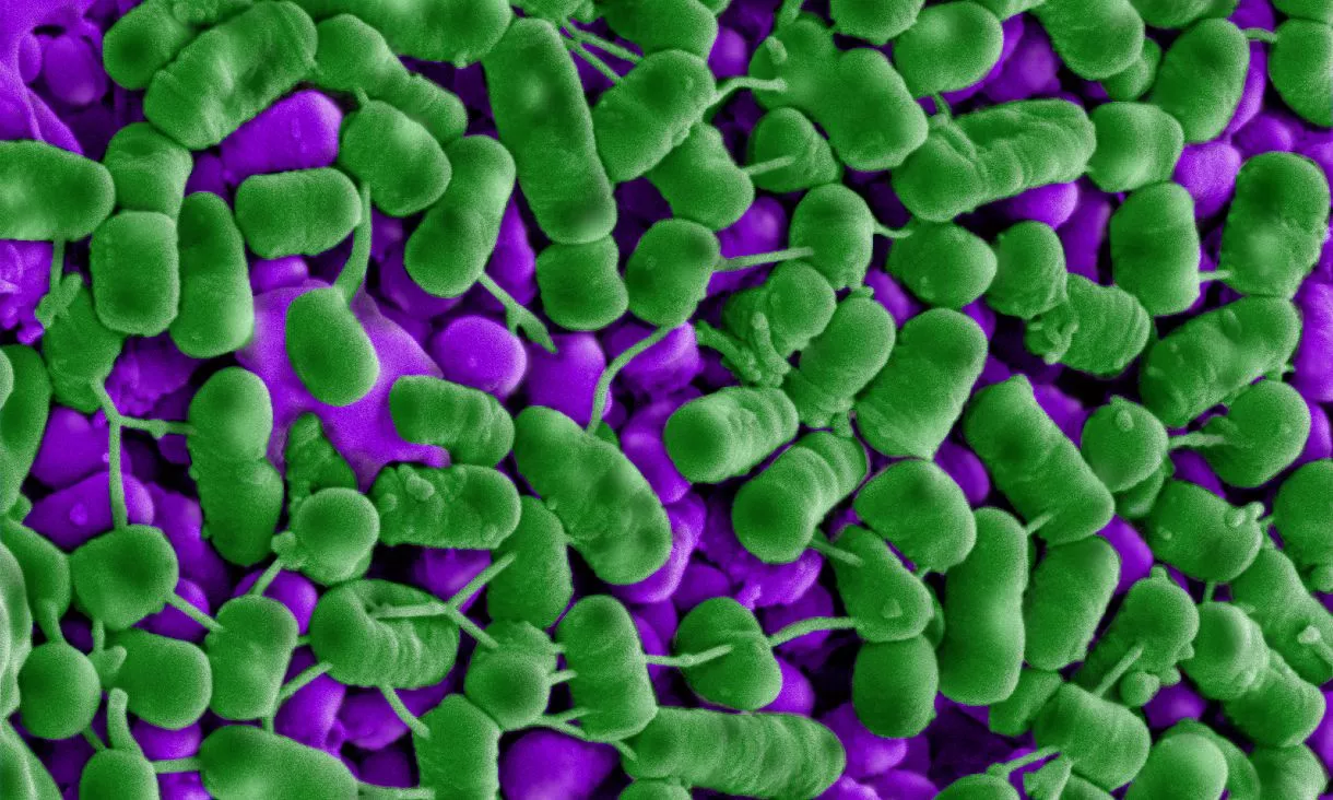 Listeria bacteria (green) dying after exposure to Plantacyclin B21AG – the bumps visible on many of the cells are the cell contents beginning to leak out