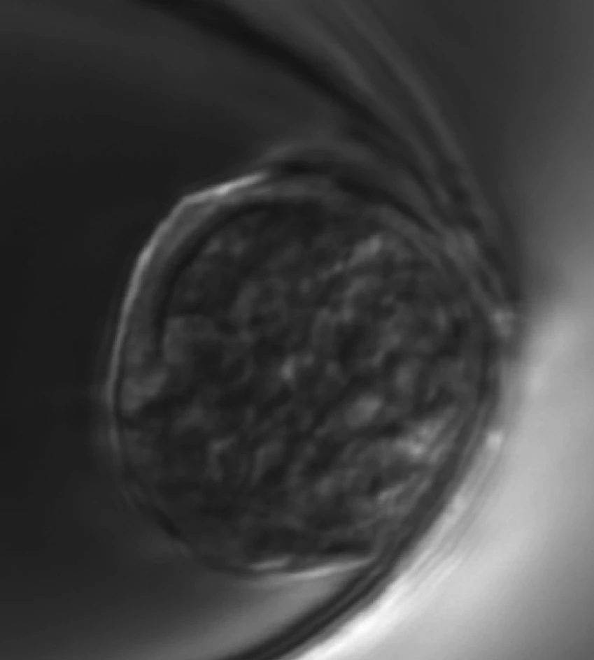 A human immune cell inside an NEP reservoir (Photo: Ohio State University)