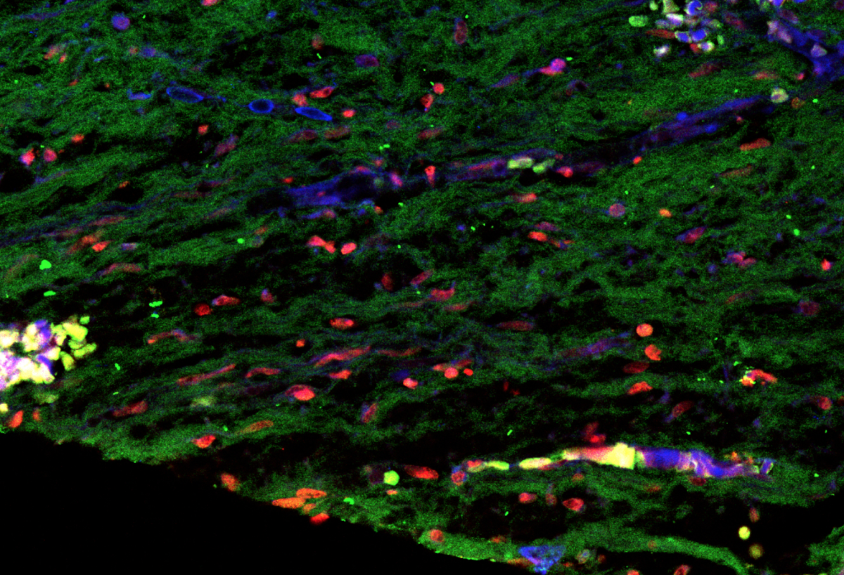Stem cells extracted from baby teeth were shown to restore pulp in injured permanent teeth