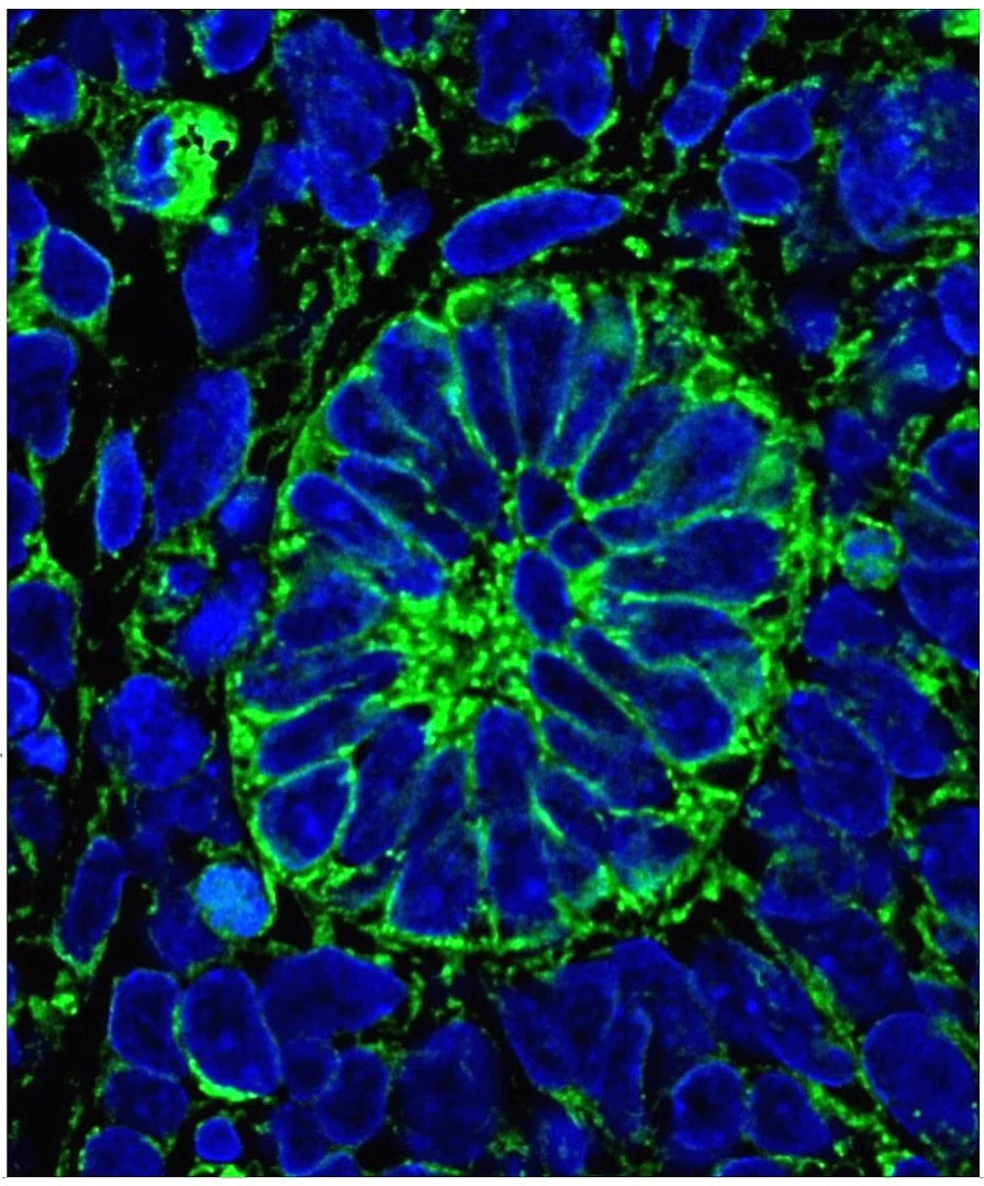 Grown in a lab from stem cells, the kidney cells developed to display organ functions after implantation into a mouse model