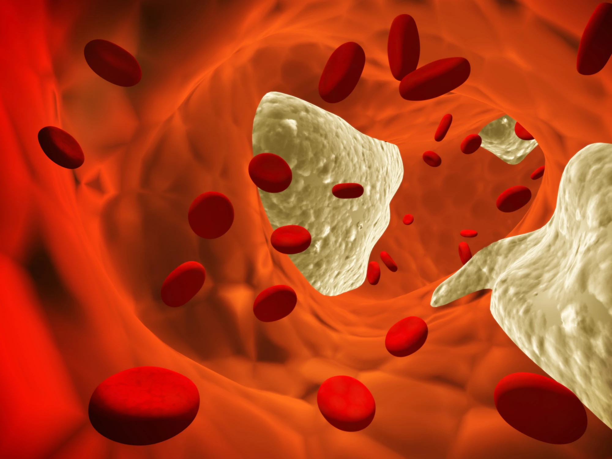 Scientists have developed a set of a molecules that cut down on cholesterol and arterial plaque by shifting the balance of bacterial species in the gut