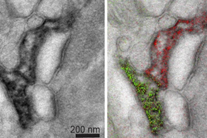 On the left is a standard grayscale electron micrograph of a mouse brain, and on the right is a Multicolor image of the same area, that better highlights the different structures and their relationship