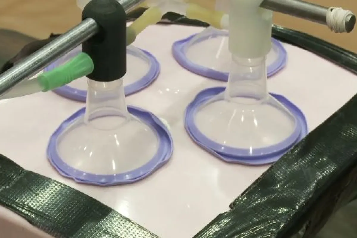 The R-Aide is designed to lift up obese patients' abdominal fat during surgery, allowing them to breathe more easily