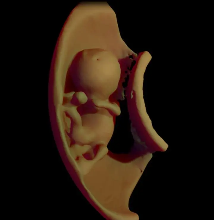 A 3-D virtual model ultrasound view of fetus at 12 weeks