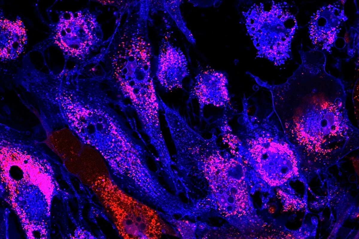 A landmark stem cell therapy to treat frailty in senior citizens is all set to move into the final phase of human clinical trials
