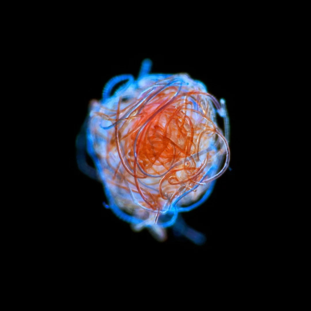 Image of Distinction: A ball of plastic microfibers, found drifting among plankton in the ocean