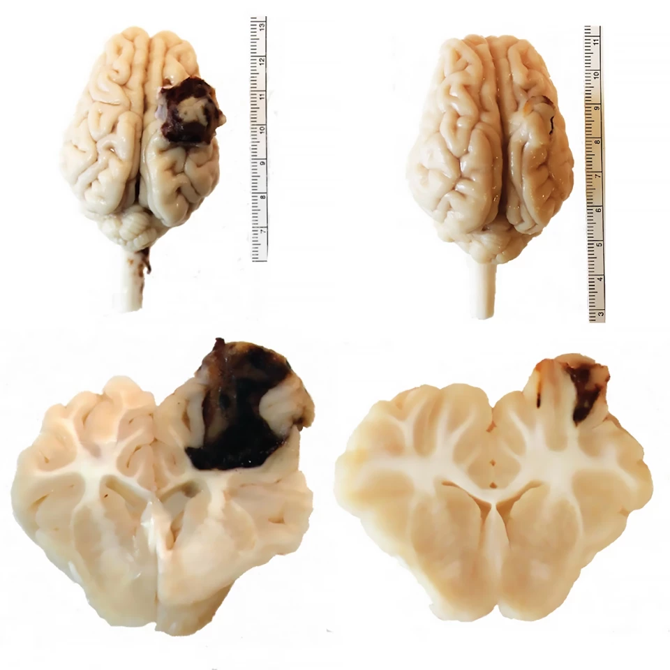 Pig brains before (left) and after treatment (right) with backpack-macrophages, which dramatically reduced the size of a lesion caused by TBI