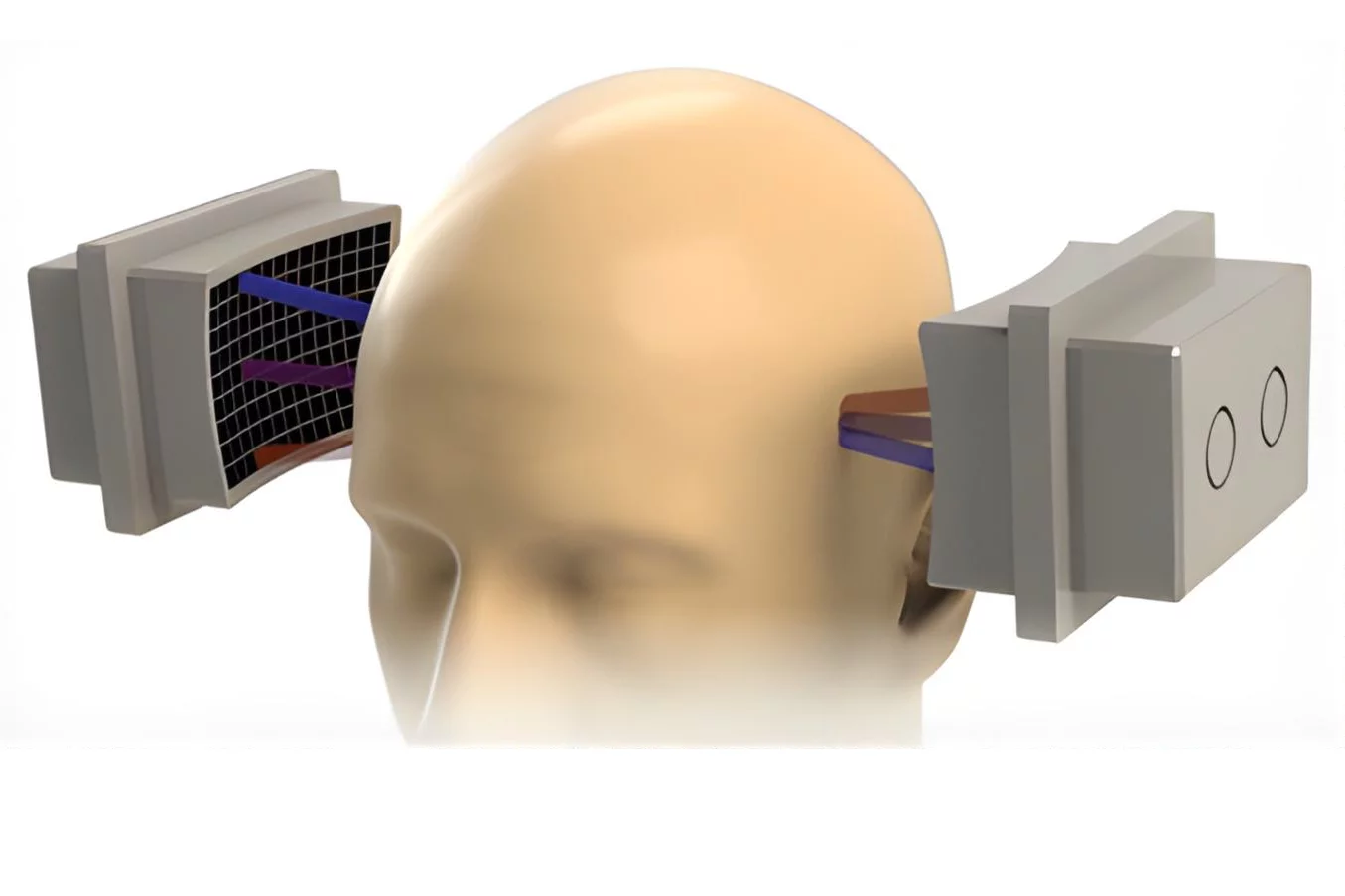 Another study participant said of the Diadem treatment: “I was walking around the grocery store and just felt so clear. I was wondering, is this what normal people feel like?”