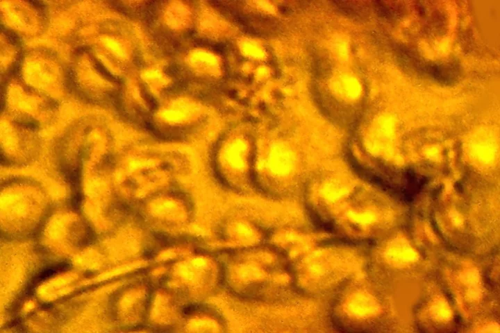 The blood cells were not only very well preserved, but they were also infected with a parasite