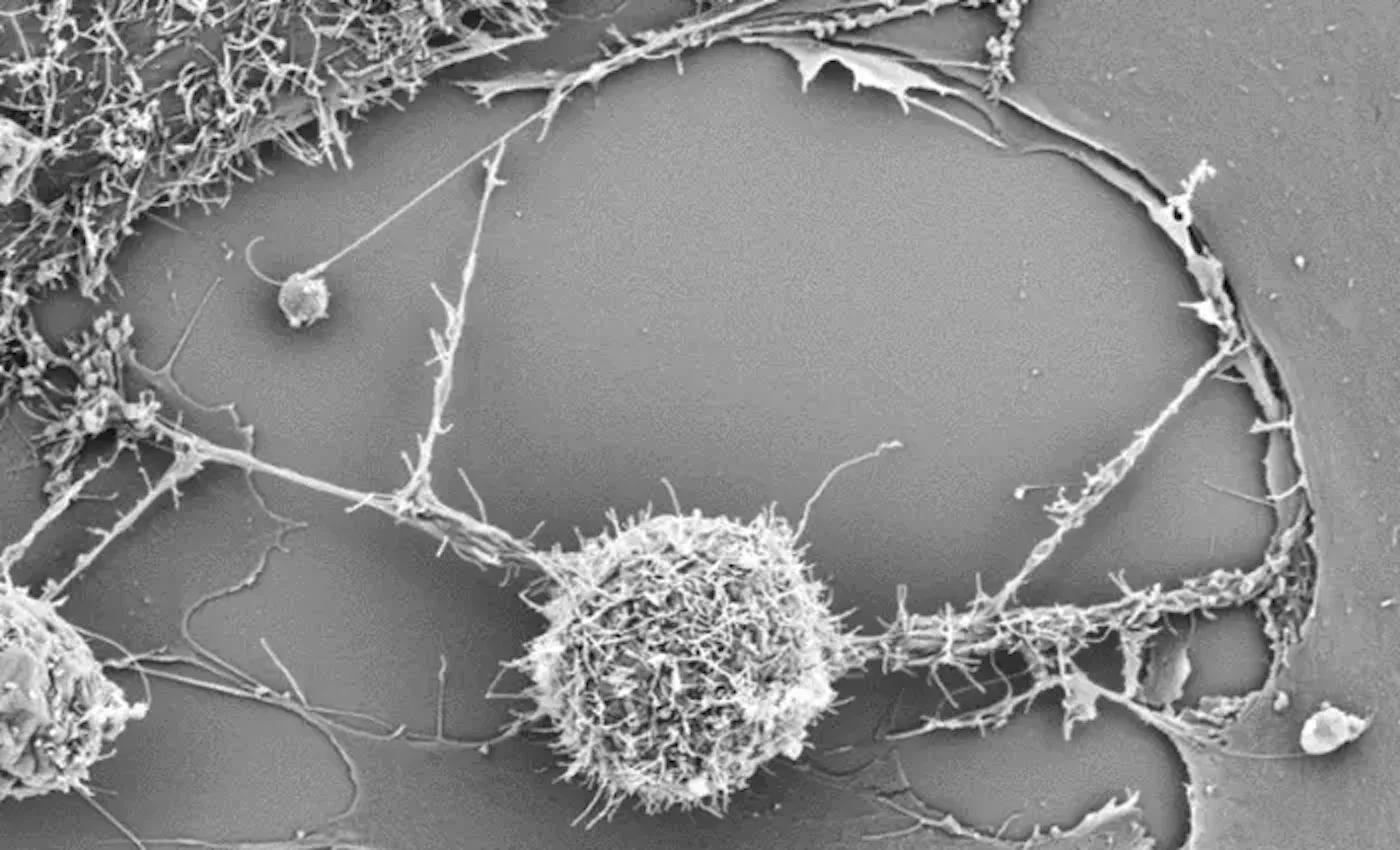 Giving immune cells extra "batteries" helps them fight cancer more effectively
