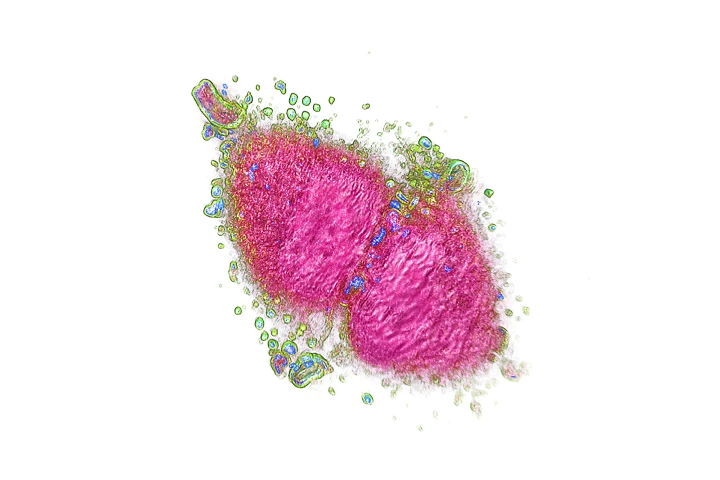 3D Cell Explorer scanned this digitally "stained" cancer cell, offering researchers a new nanometer-scale look into live cells