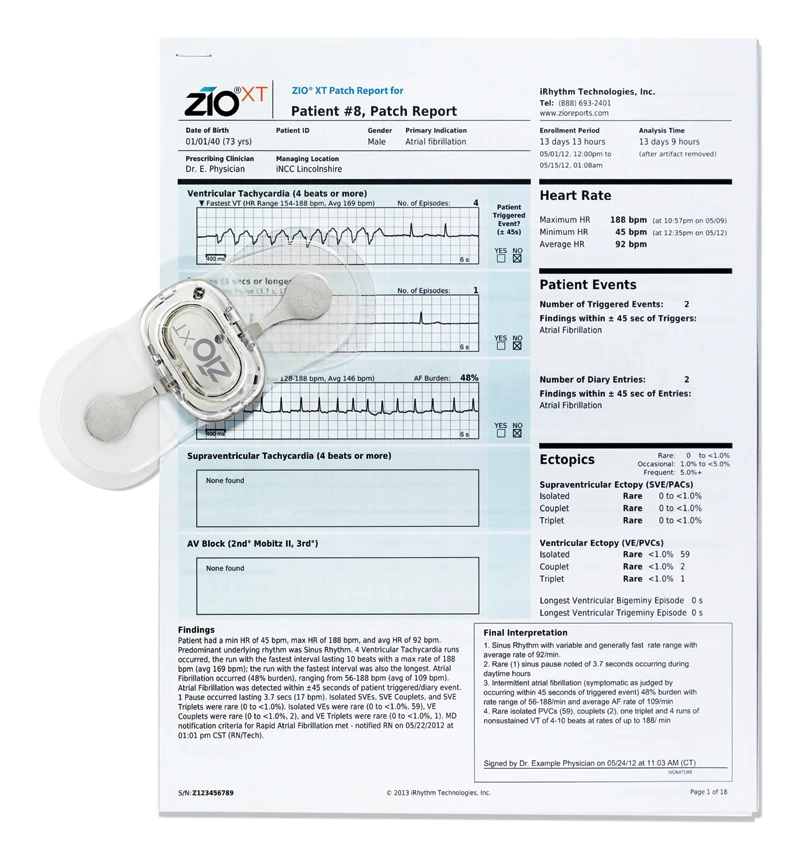 A ZIO Patch, with a report on its wearer (Photo: iRhythm Technologies)