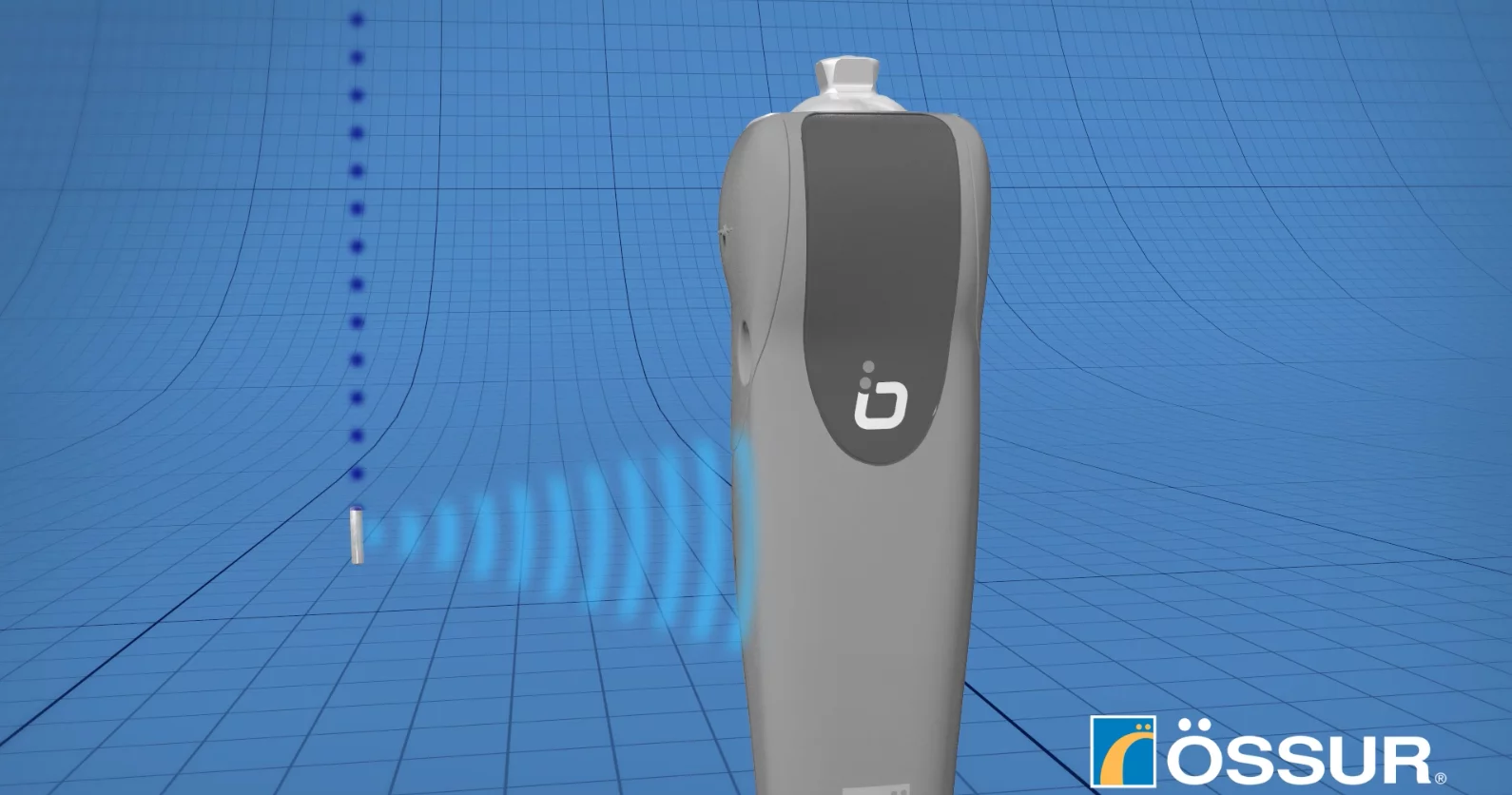 The bionic limb technology uses sensors wirelessly connected to the prosthesis