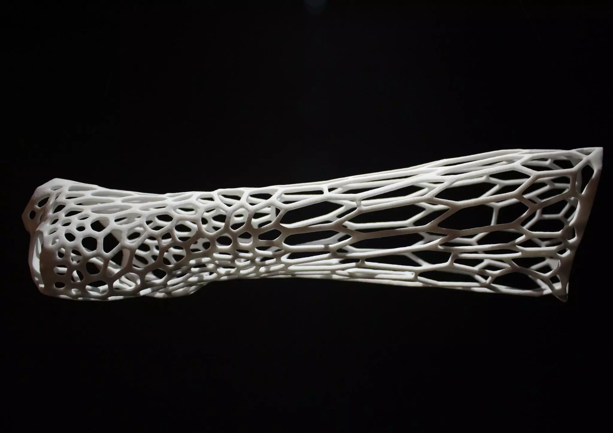 The Cortex Fracture Support is based on biological design