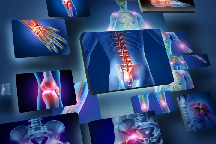 The stereovision system can be used to show where the surgeon needs to apply tools and implants
