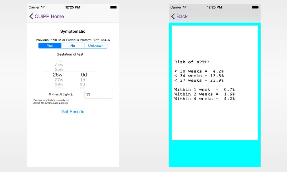 The researchers' algorithm is available via an iOS app known as QUiPP
