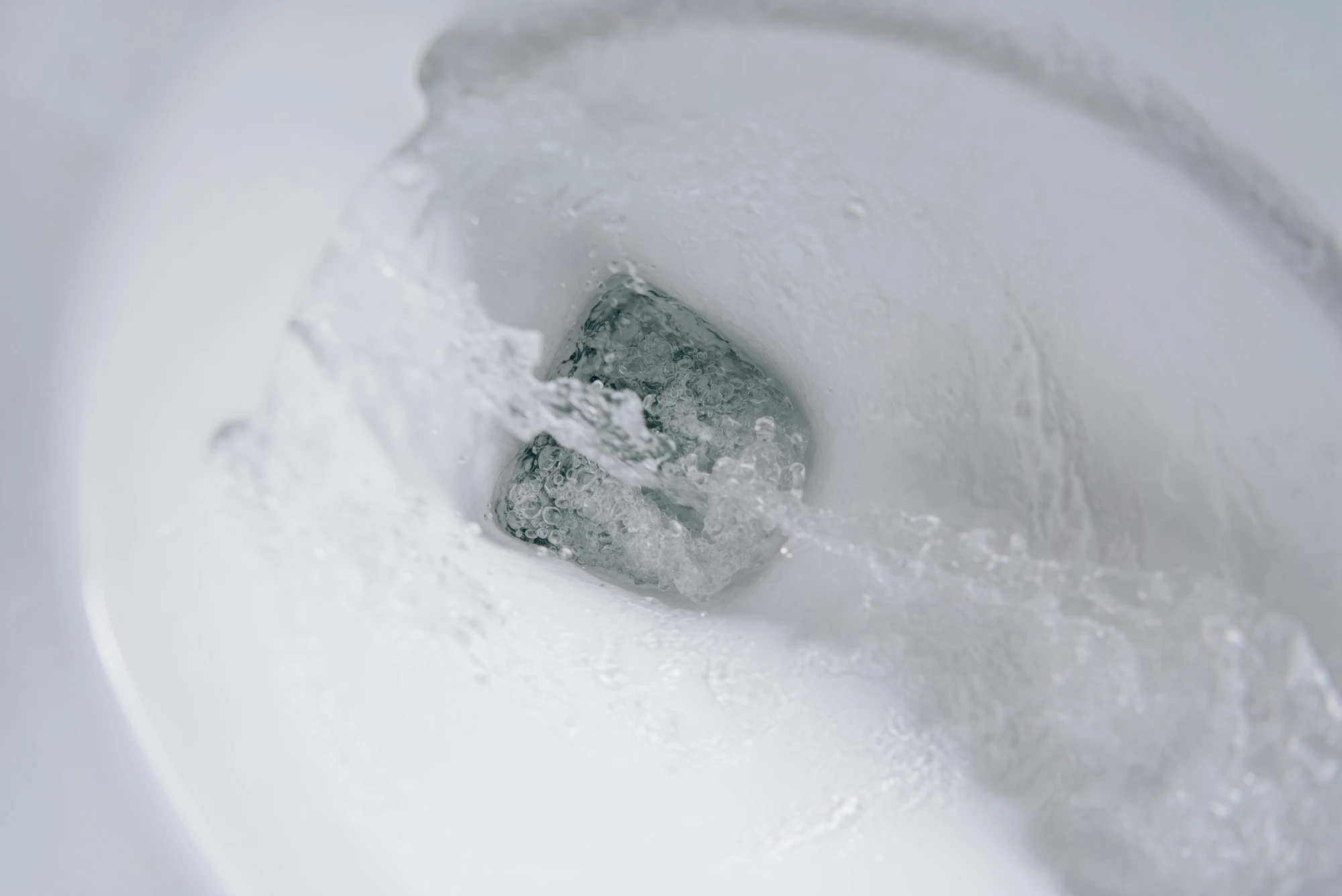 Stanford's smart toilet technology can be retrofitted to existing bowls to monitor samples for signs of disease