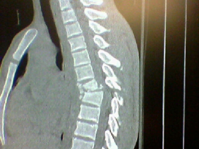 Spines aren't supposed to look like that.