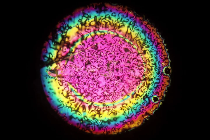 University of Leeds research student Devesh Mistry has developed a unique, auto-focusing liquid crystal lens that may help cure age-related long-sightedness
