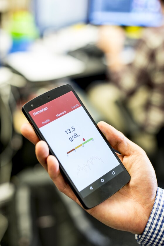 By assessing the color of the glow through special algorithms, HemaApp can then make an estimation of the patient's hemoglobin levels