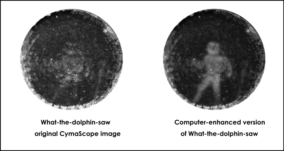 Contrast-enhanced image of the cymascope image
