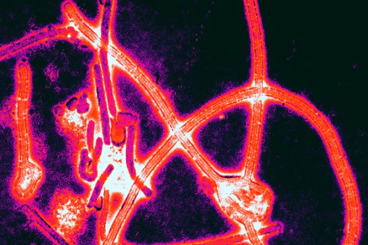 A new biosensor can instantly detect viruses such as Ebola (pictured), with little or no sample preparation (Image: Thomas W. Geisbert, Boston University School of Medicine)