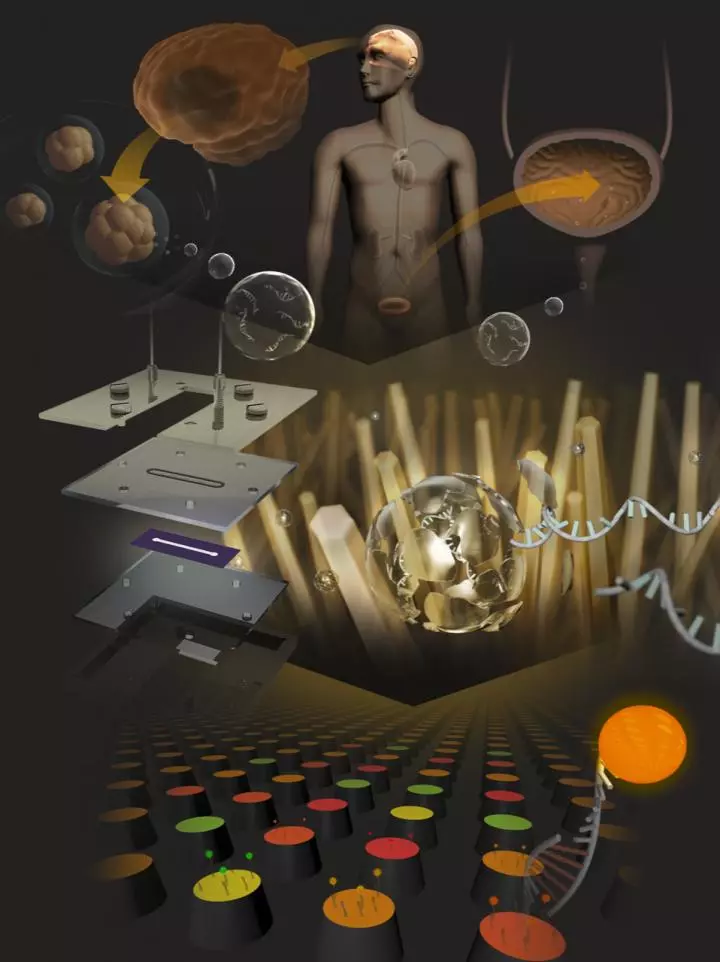 A schematic illustrating a new technology that uses nanowires to collect microRNAs associated with brain tumors from a patient's urine samples