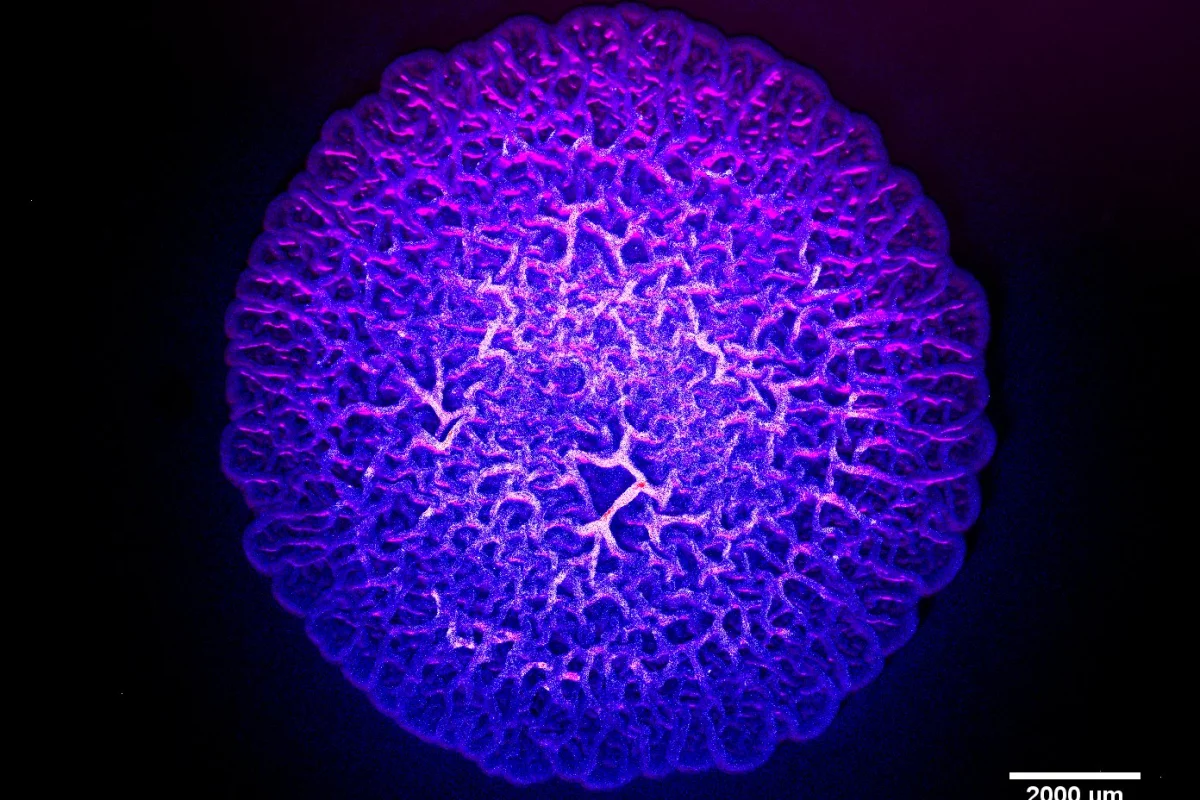 A colony of Pseudomonas aeruginosa grown in a dish for three days
