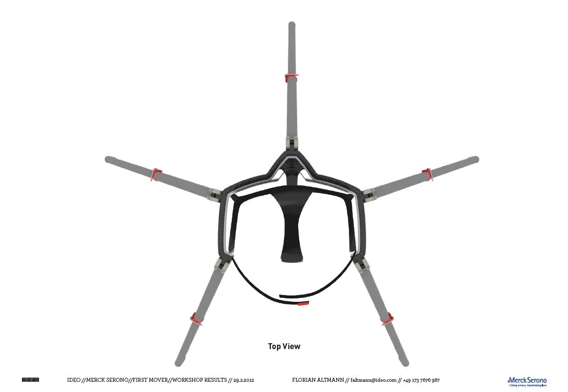 The production version of the Sports Walker would have telescoping legs, to adjust for the height of the user
